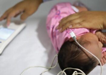 El tamiz auditivo neonatal es trascendental para detectar oportunamente problemas de sordera