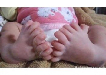 Una bebé nació con 26 dedos y la consideran reencarnación de una diosa de la India