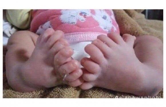 Una bebé nació con 26 dedos y la consideran reencarnación de una diosa de la India