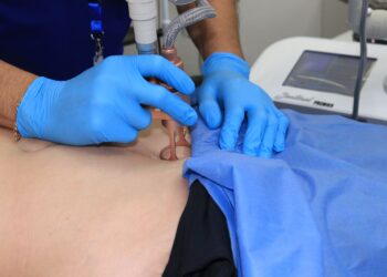 DIF Bienestar y Grupo PH, implementan jornada gratuita de tratamientos con laser