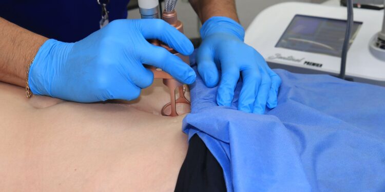 DIF Bienestar y Grupo PH, implementan jornada gratuita de tratamientos con laser