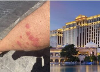 Detectan brote de chinches en cuatro de los hoteles más conocidos en Las Vegas