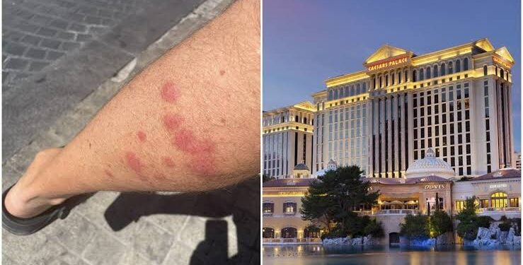 Detectan brote de chinches en cuatro de los hoteles más conocidos en Las Vegas