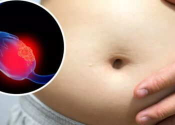 El cáncer de ovario, la segunda causa de muerte en México dentro de los padecimientos ginecológicos en mujeres mayores de 45 años