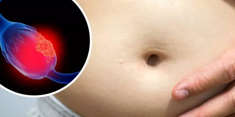 El cáncer de ovario, la segunda causa de muerte en México dentro de los padecimientos ginecológicos en mujeres mayores de 45 años