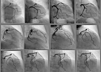 Doctorando de la UAS desarrolla método experimental a partir de imágenes de angiogramas para prevenir enfermedades cardiacas graves