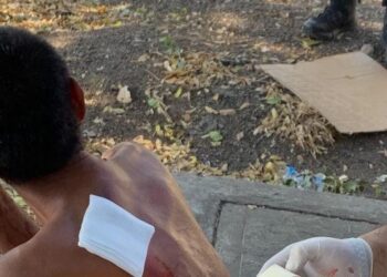 Agresión a balazos en la calzada José Limón deja a un hombre herido