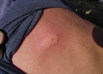 Protección Civil alerta por aumento de reportes de picaduras de abejas en Sinaloa