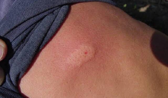 Protección Civil alerta por aumento de reportes de picaduras de abejas en Sinaloa