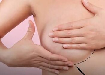 Cada año, 600 mujeres reciben diagnóstico de cáncer de mama en Sinaloa; impulsan cirugías gratuitas de reconstrucción