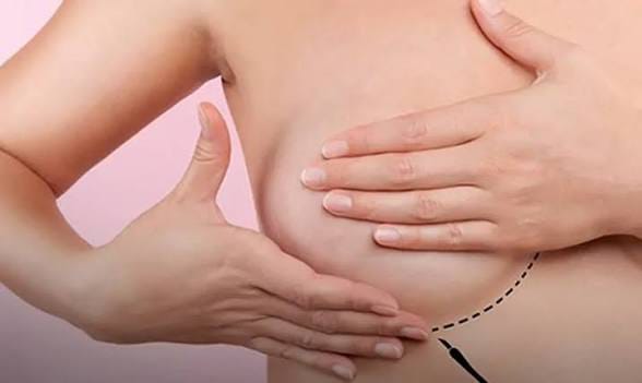 Cada año, 600 mujeres reciben diagnóstico de cáncer de mama en Sinaloa; impulsan cirugías gratuitas de reconstrucción